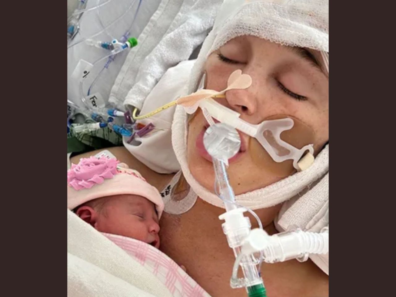 W 9. miesiącu upadła w łazience. Urodziła w śpiączce