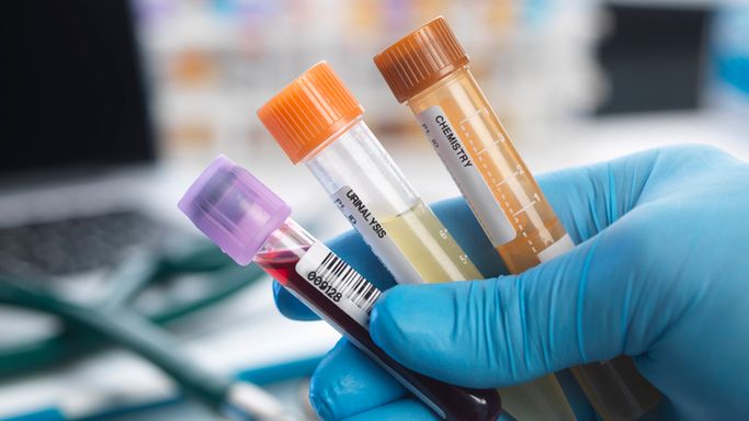 Renina to enzym nerkowy i element układu renina-angiotensyna-aldosteron.