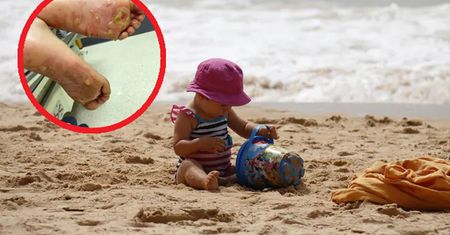 2-latka nagle zaczęła krzyczeć. Tak skończył się dzień plażowania