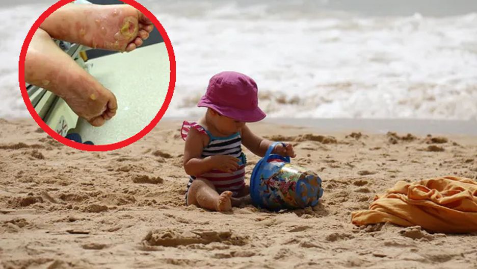 Nagle 2-latka zaczęła krzyczeć. Bolesny finał plażowania