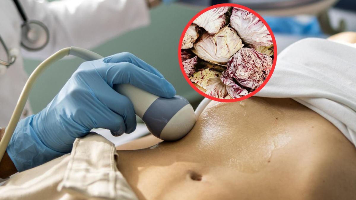 Prosty składnik diety może cofnąć uszkodzenia wątroby. Nowa nadzieja dla chorych