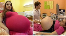 Badanie wyjaśniło, dlaczego w ciąży bliźniaczej miała tak duży brzuch