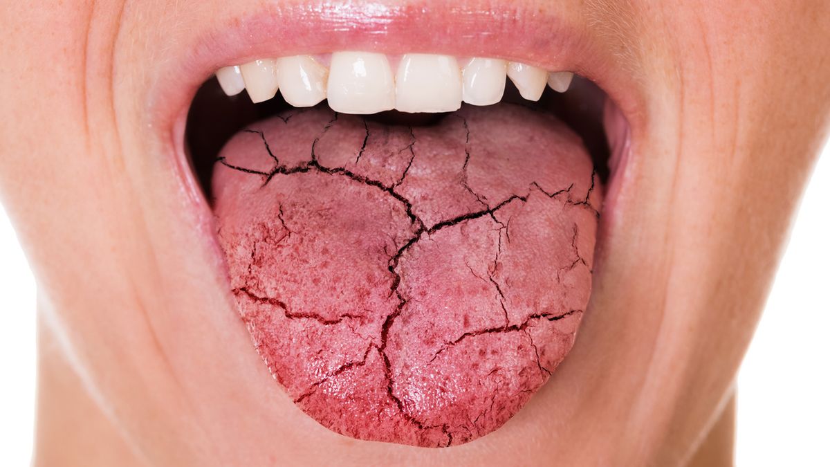 Choroba Behceta to rzadka choroba układowa naczyń