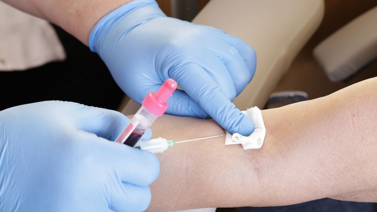 Haptoglobina to tzw. białko ostrej fazy, które oznacza się na podstawie próbki krwi żylnej.