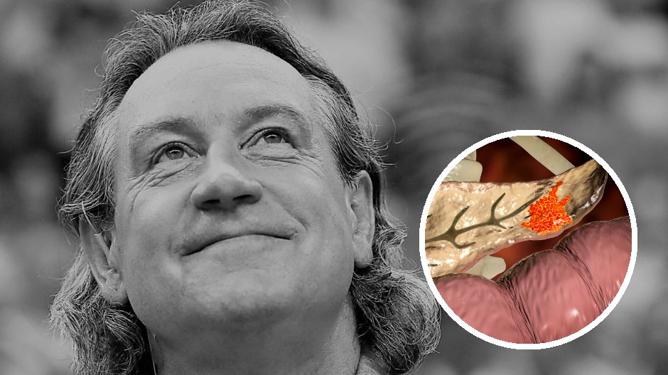 Pierwszym objawem raka trzustki u Tomasza Wójtowicza była żółtaczka