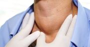 Wole - podział woli, przyczyny powiększenia tarczycy, wole guzowate, wole nadczynne, leczenie