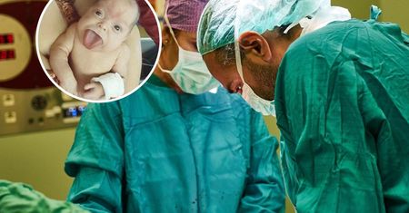 Usunięto ponad 14 cm języka. Wtedy uśmiechnęła się pierwszy raz