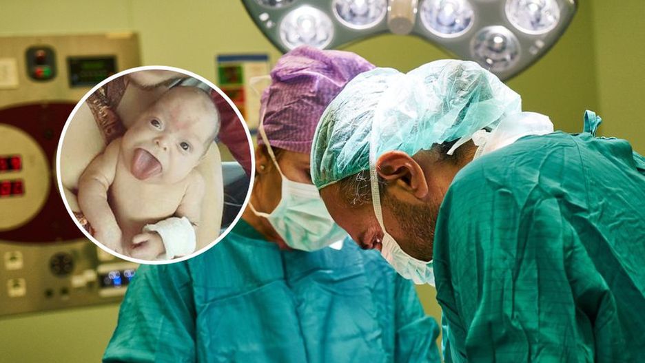 Urodziła się z ogromnym językiem. Dziewczynka nie była w stanie samodzielnie oddychać