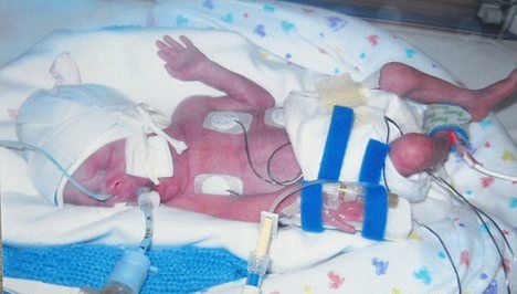 Daniel urodził się jako wcześniak