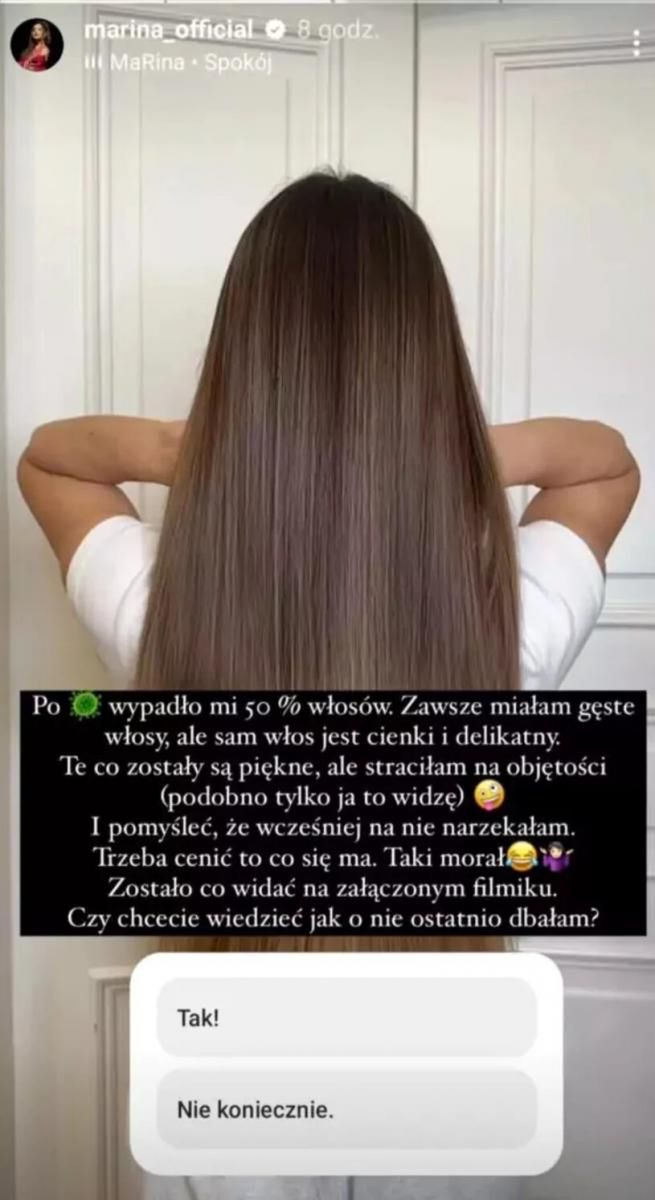 Marina Łuczenko-Szczęsna straciła włosy po chorobie