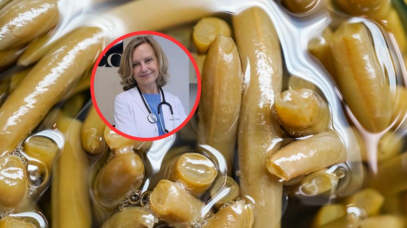 Jak zbić cholesterol bez leków?