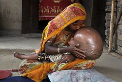 Rodziców nie stać na leczenie chorej dziewczynki