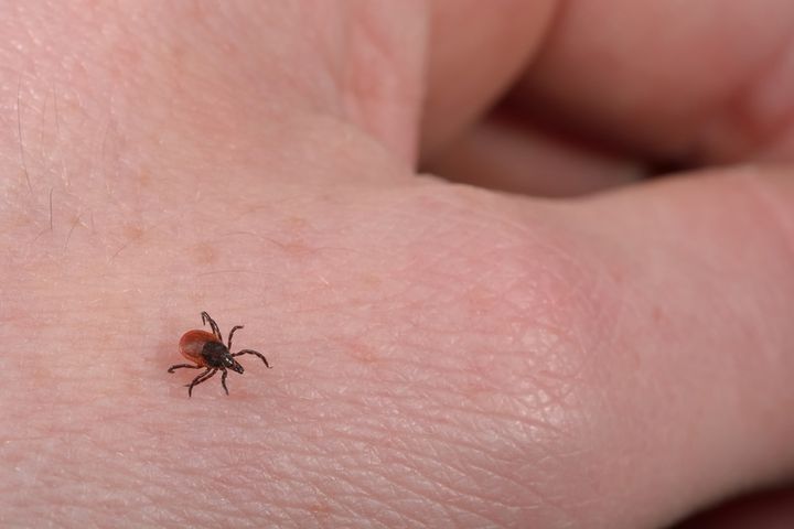 Borelioza - choroba trudna do zdiagnozowania