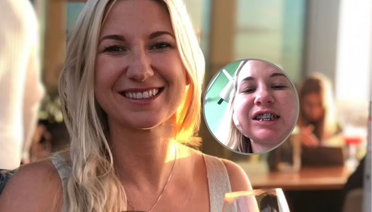 38-latka ze złamaną szczęką po koszmarnym zabiegu w SPA