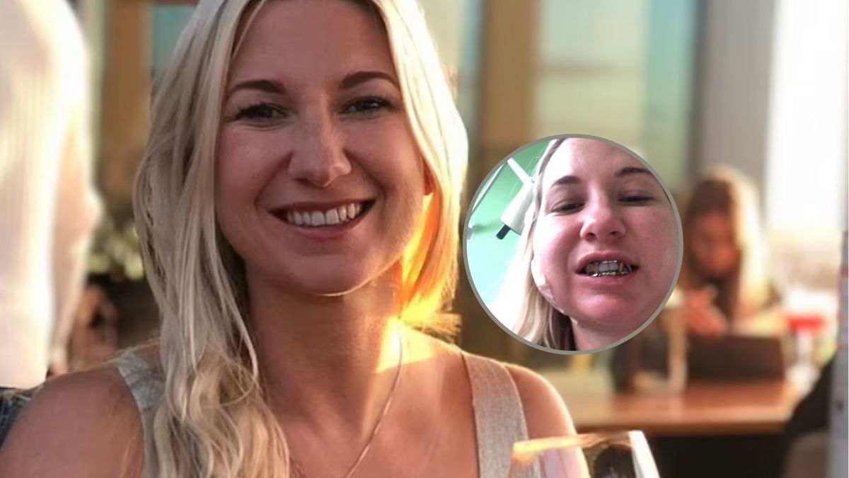 38-latka ze złamaną szczęką po koszmarnym zabiegu w SPA