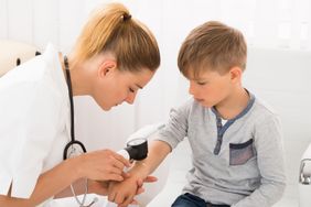 Znamiona u dziecka - kiedy iść do lekarza?