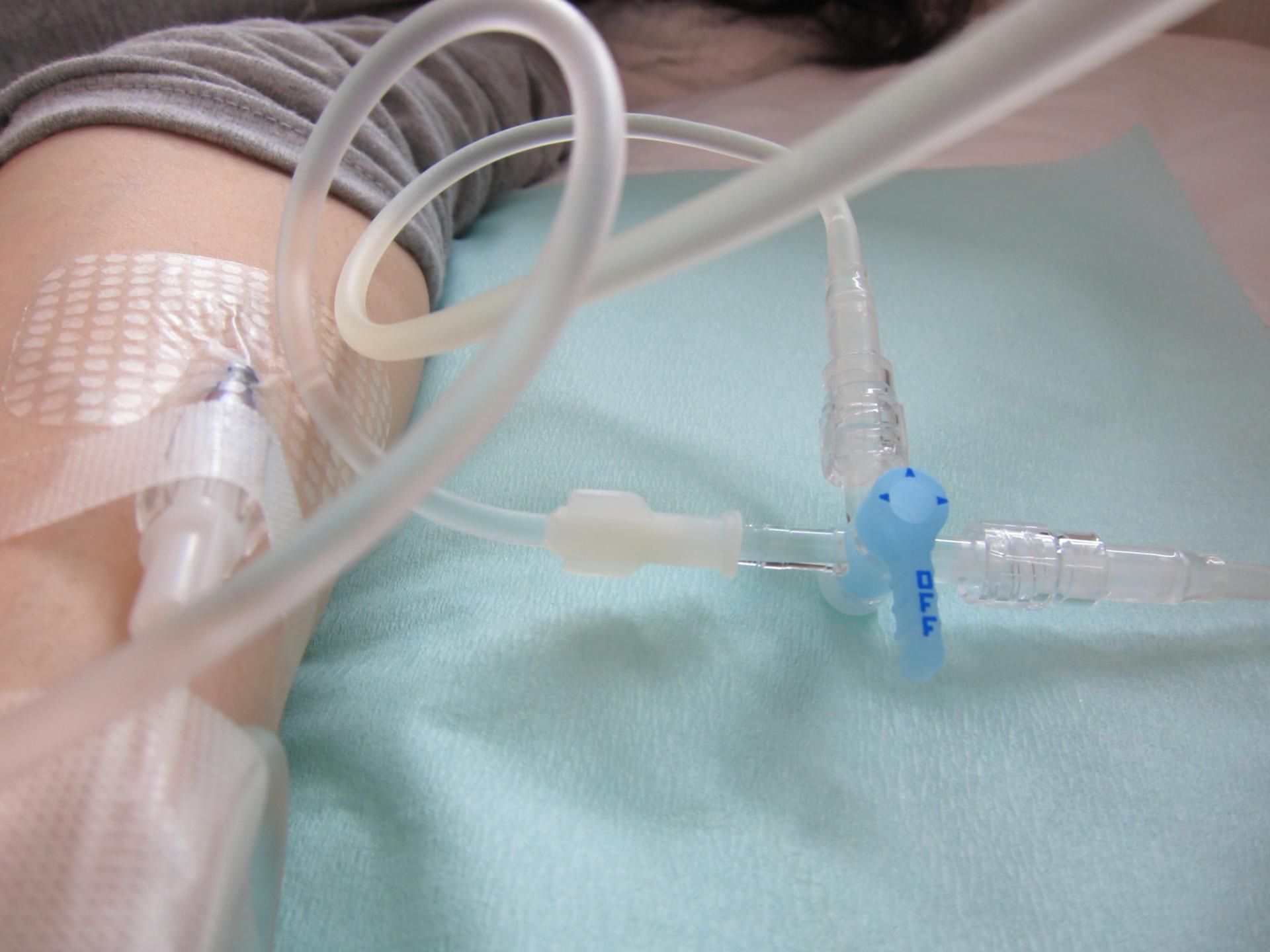 Nowa nadzieja dla pacjentów z rakiem trzustki