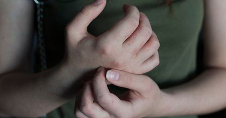 Pokrzywka alergiczna - objawy, przyczyny, diagnostyka i leczenie
