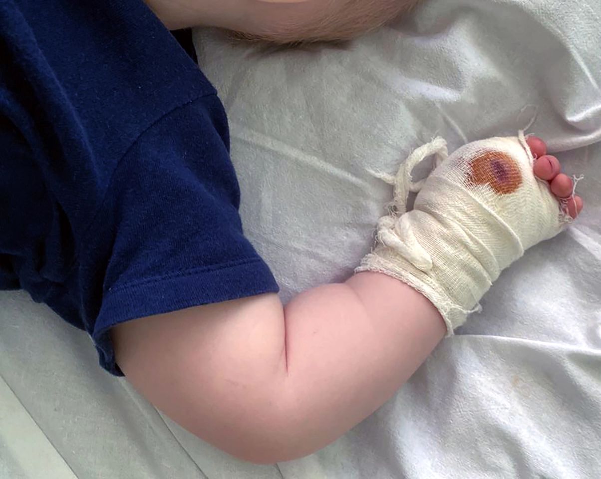 Chłopiec trafił do szpitala