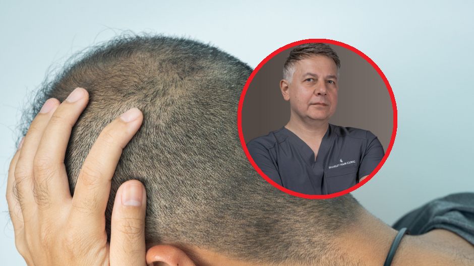 Polacy marzą o pięknych włosach, ale wybierają drogę na skróty. Najczęściej prowadzi ona do Turcji