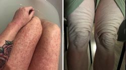 Cierpiała na TSW. "Śmierdziałam jak zmokły pies"