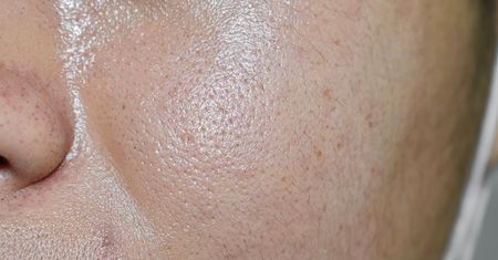 Sebum – funkcje, skład i nadmierne wydzielanie