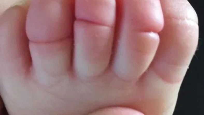 Chwila nieuwagi mogła kosztować dziecko utratę palców