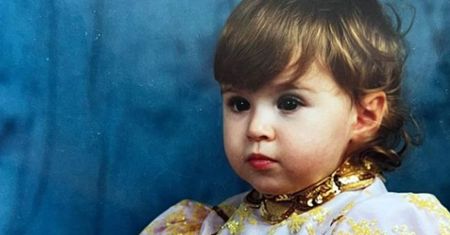 Przez 18 lat ukrywała twarz. Właśnie skończyła 24 lata