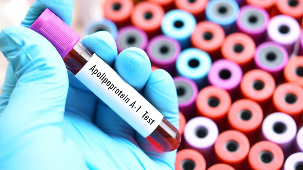 Apolipoproteina A1 (Apo A1) - co to jest, cel badania, normy, spadek, wzrost