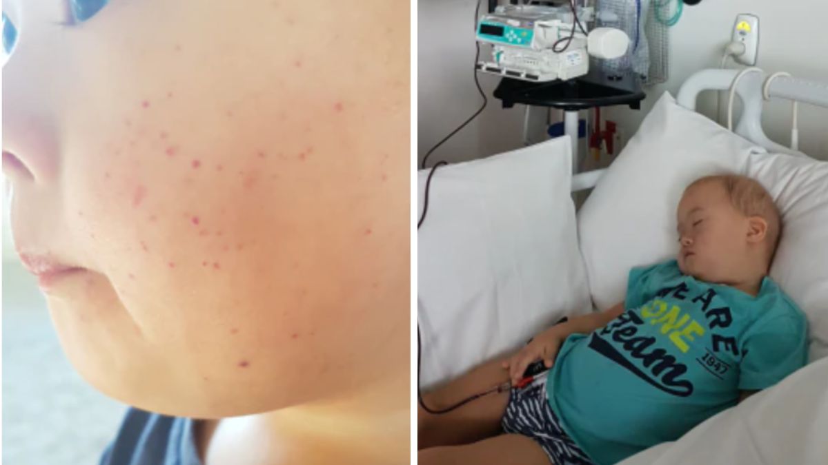 Maluch potrzebował aż sześciu rund chemioterapii