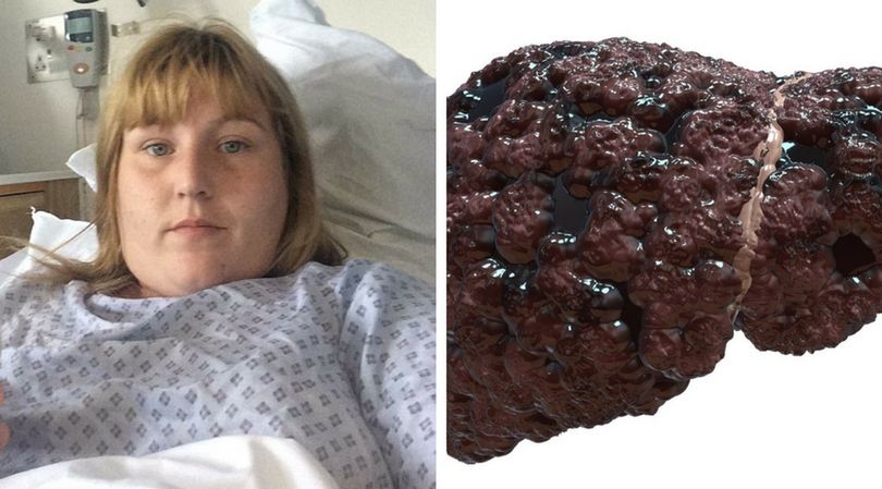 Maria Allwood - 26-latka uwielbiała napoje energetyczne. Miała wątrobę