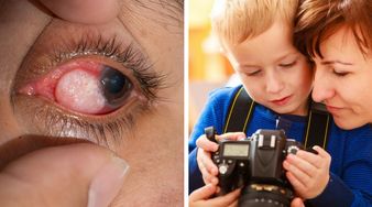 Choroby oczu dzieci, które można wykryć na podstawie zdjęcia