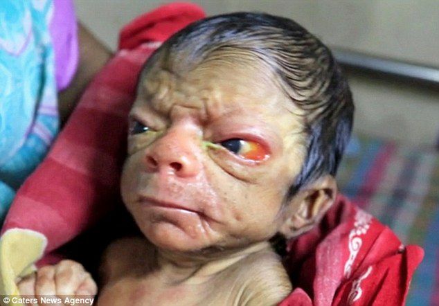 Prawdopodobnie jego wygląd powoduje rzadka choroba - progeria