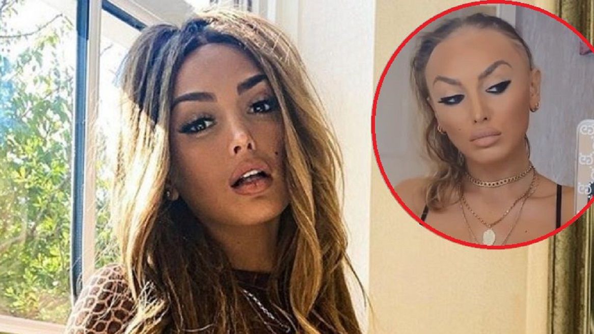 ZaraLana opowiada o łysieniu na swoim instagramie