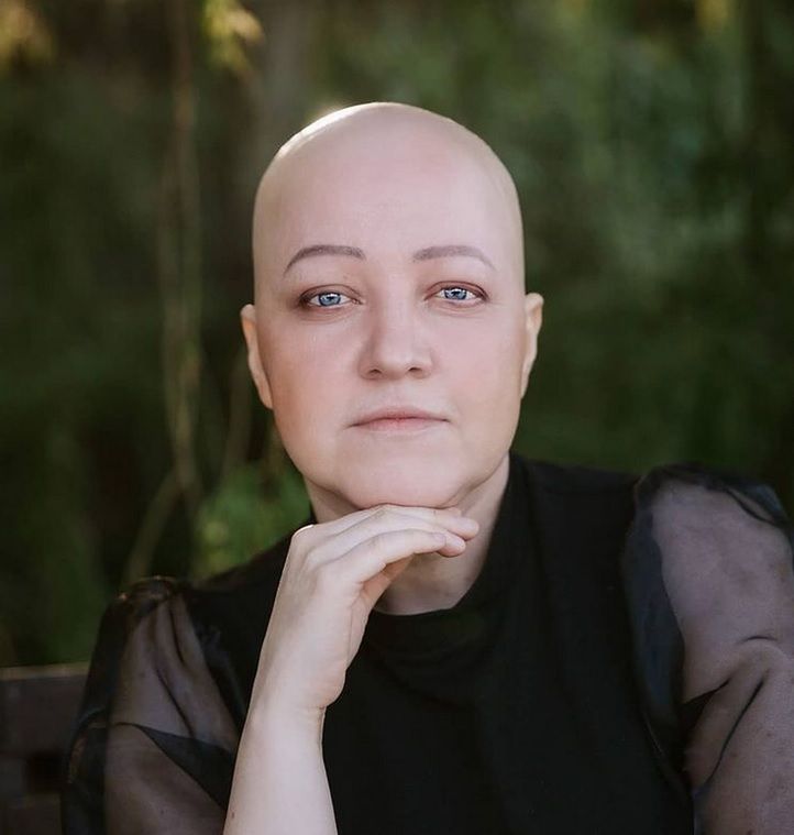 Marta rzadko wychodzi z domu bez peruki