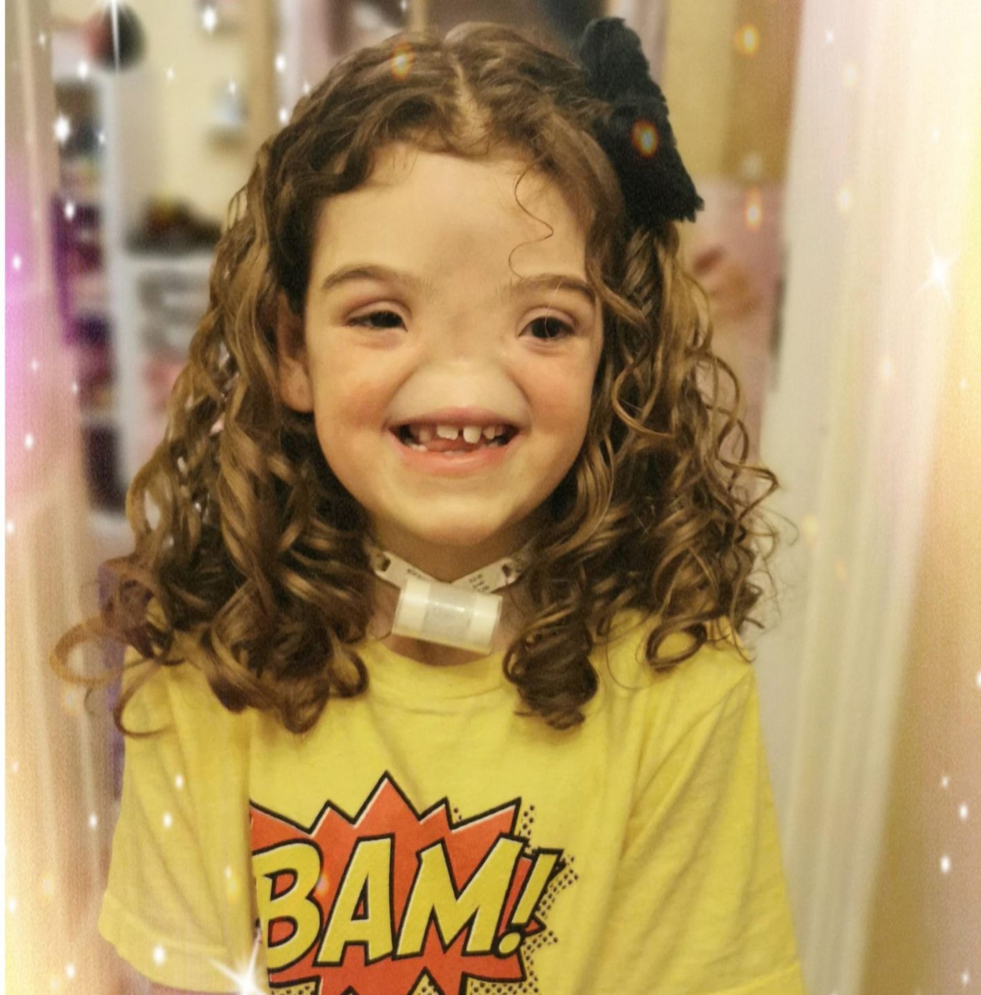 Tessa cierpi na zespół BAM