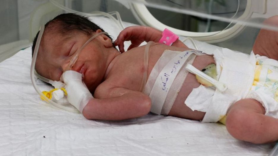 Lekarze wyciągnęli dziecko z ciała zabitej matki. "Nawet jeśli przeżyje, urodziło się sierotą"