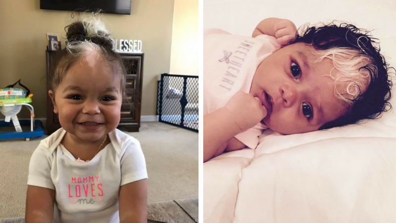 Wśród czarnych loków na głowie dziewczynki widać białe pasmo włosów