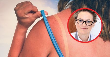 Opalasz się na czerwono, bo masz "taką urodę"? To błędne myślenie