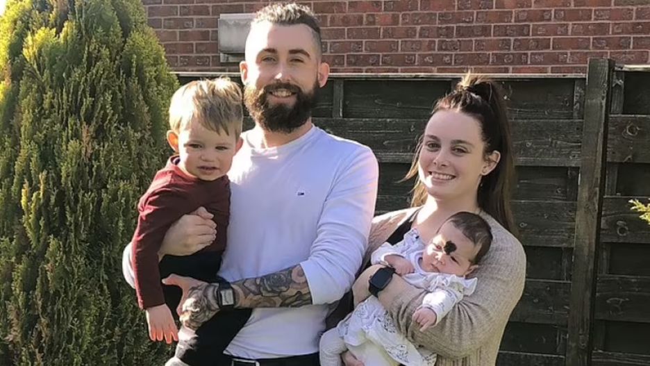 Dziewczynka urodziła się ze znamieniem na twarzy