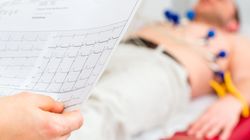 Angina Prinzmetala - przyczyny, objawy i leczenie