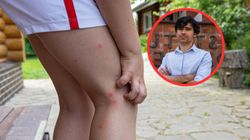 Wirus chikungunya jest w Polsce. Ekspert mówi, jakie daje objawy