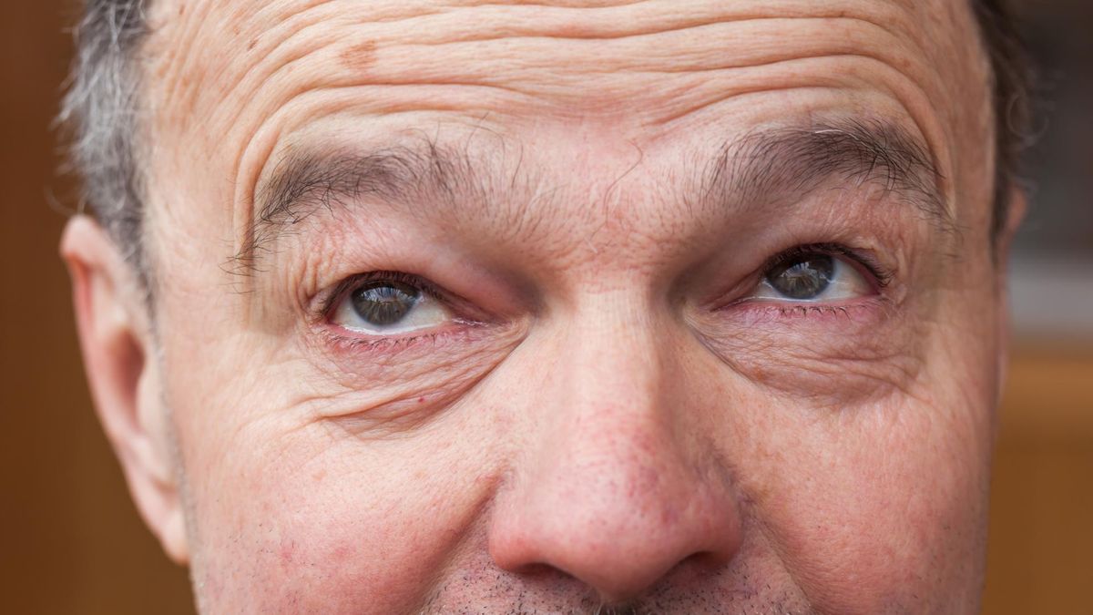 O czym mogą świadczyć zmarszczki na twarzy?