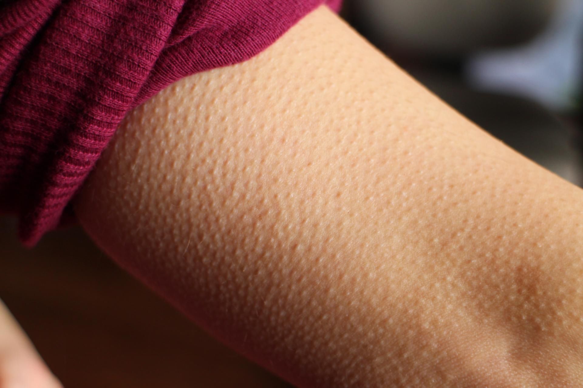 Zimno? Winne mogą być niedobory witamin