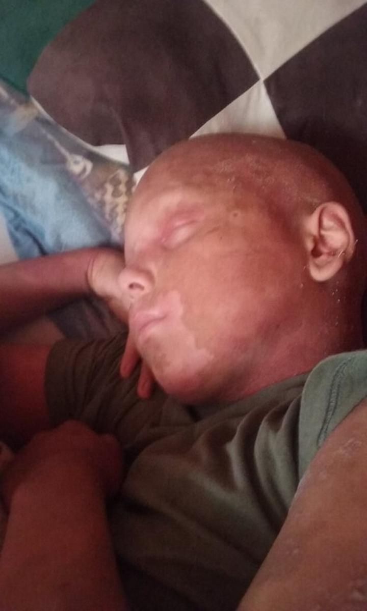 Adam codziennie skarży się na ból całego ciała