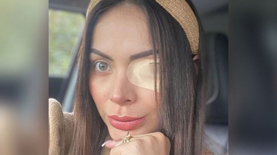 Modelka prawie straciła wzrok (Facebook)