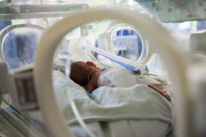 Niewydolność oddechowa u noworodka objawia się problemami z samodzielnym oddychaniem