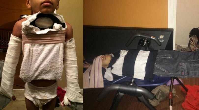 Zdjęcia ukazujące tortury nad Adrianem