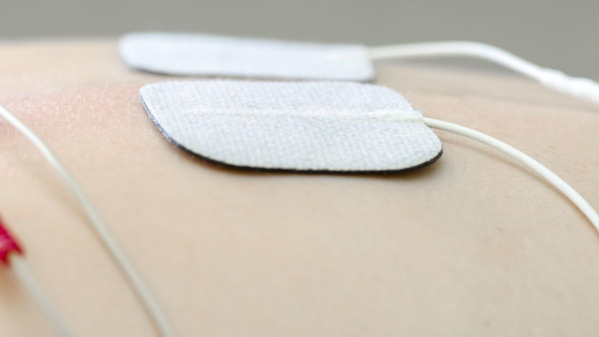 TENS to metoda obecna również na polskich salach porodowych  