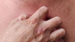 Zauważyłeś na skórze? Biegiem do lekarza. Tak trzustka woła o pomoc